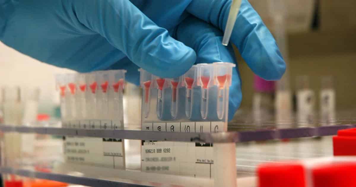 bloodtestcancerfeatured Elite Readers