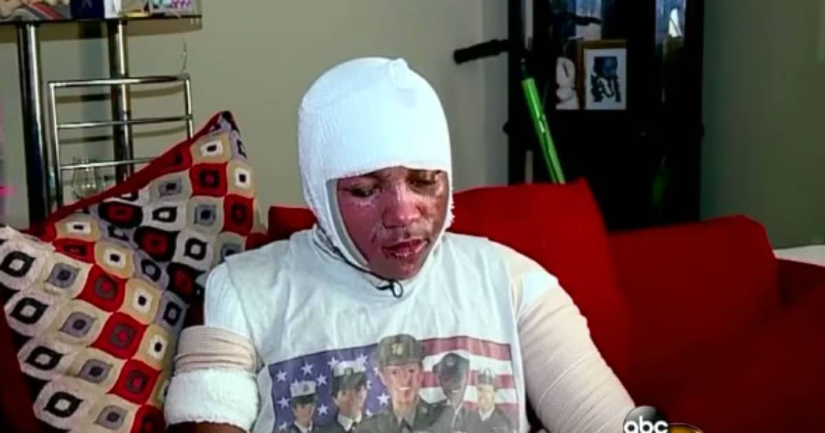 Kids Are Pouring Boiling Water On Each Other In Crazy YouTube Challenge