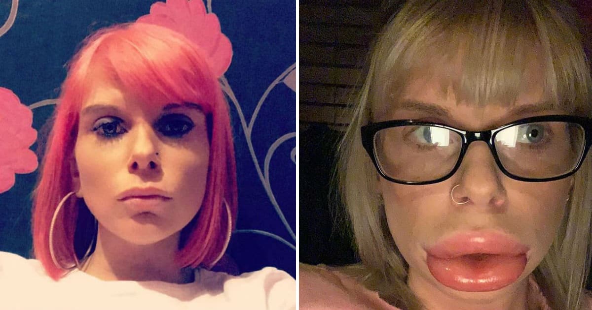 sausage lips Elite Readers